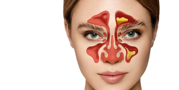 Best Sinus Surgery in Kandivali